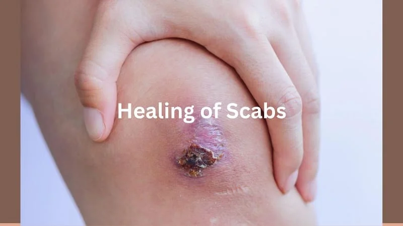 Why Is My Scab So Thick
