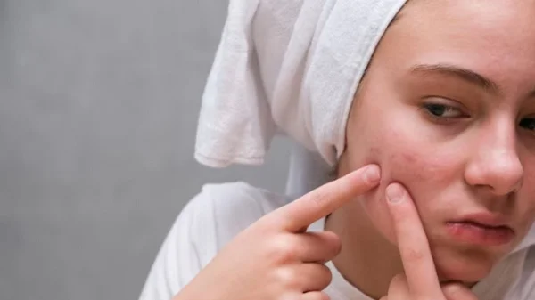 My pores are always clogged with white stuff