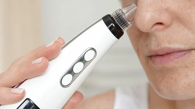 Are blackhead vacuums safe